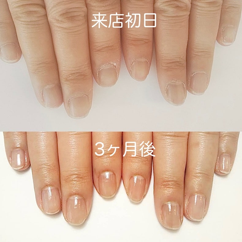 越谷ネイルケアサロン|美爪育成ネイルケアならINAIL-アイネイル-