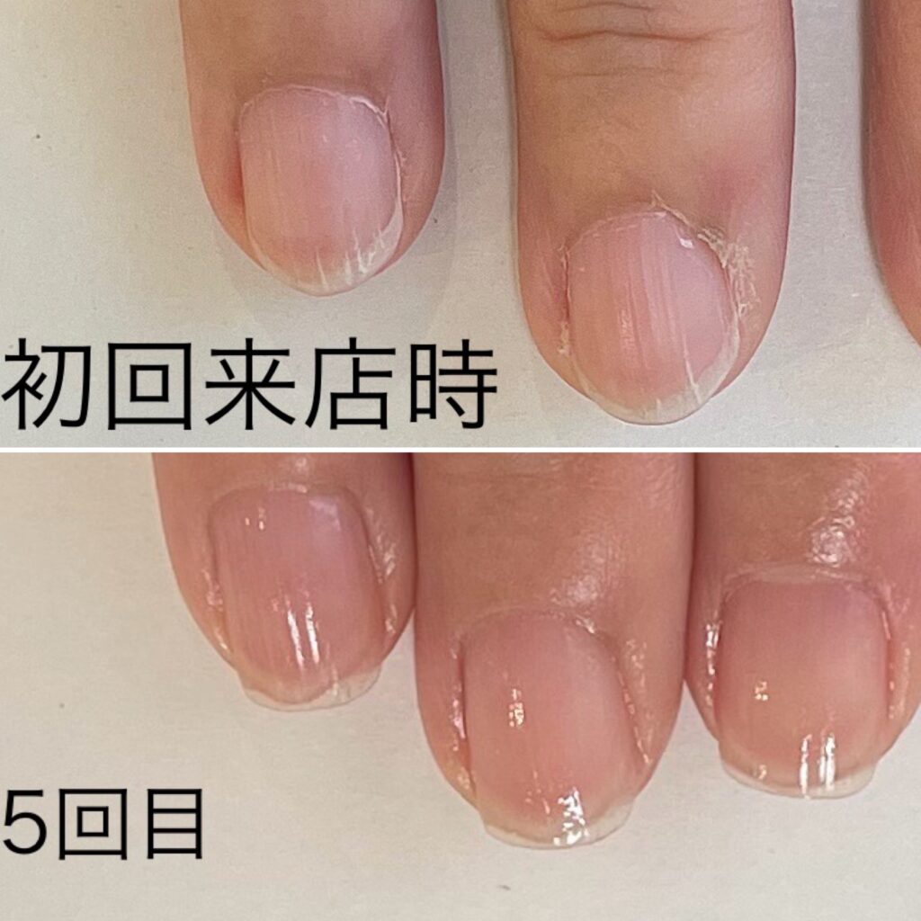 越谷ネイルケアサロン|美爪育成ネイルケアならINAIL-アイネイル-