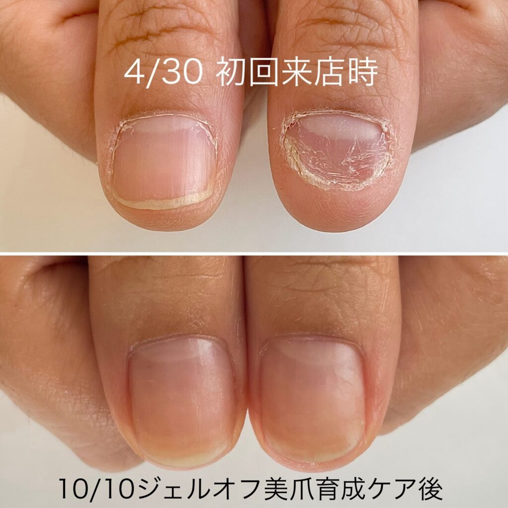 越谷ネイルケアサロン｜美爪育成ネイルケアならINAIL-アイネイル-