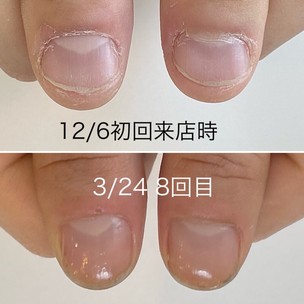 越谷ネイルケアサロン｜美爪育成ネイルケアならINAIL-アイネイル-
